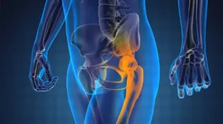 Prostate cancer: A curable ailment that causes social stigma