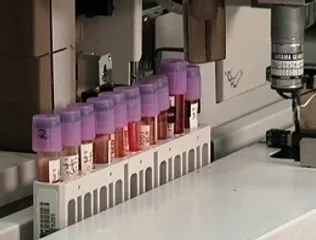 New blood test to help detect risk of 30 age-related diseases