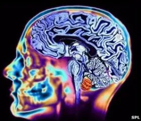 Study shows childhood air pollution exposure may impair cognitive, self-control abilities