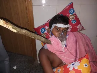 Odisha: Minor boy critical after tree branch gets lodged in neck