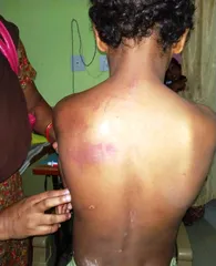 Child Labour: Minor boy brutally beaten by noodles factory owner in Odisha