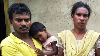 Succour in sight for poverty-stricken former woman footballer from Odisha