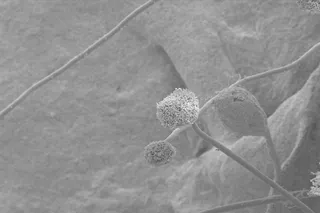 White fungus: Here's what Odisha doctor says