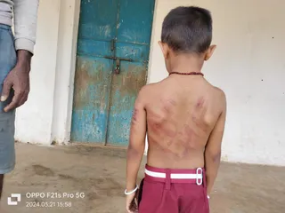 Odisha teacher held for meting out corporal punishment to nursery student