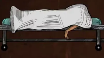 Representative Image