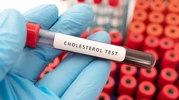 Cholesterol Test