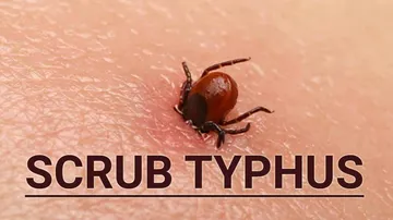 Scrub Typhus