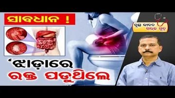 କୋଲନ୍ କ୍ୟାନସର କ’ଣ? ଏହାର ଲକ୍ଷଣ କ’ଣ?