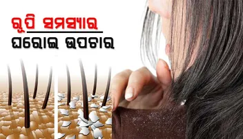 ଶୀତ ଦିନେ ରୂପି ସମସ୍ୟାରୁ ମୁକ୍ତି ପାଇବା ପାଇଁ ଆପଣାନ୍ତୁ ଏହି ସବୁ ଘରୋଇ ଉପାୟ 