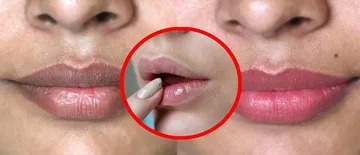 ଓଠ କଳା ପଡିଛି କି? ଆପଣାନ୍ତୁ ଏହି ୫ଟି ଟିପ୍ସ