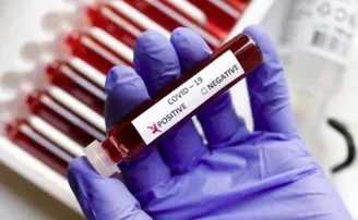 ଦେଶରେ ୪୨୮୧ ଆକ୍ରାନ୍ତ, ଗଲାଣି ୧୧୧ ଜୀବନ