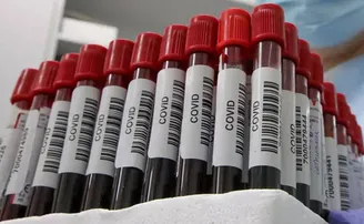 ପୁଣି ବଢ଼ିଲା ଏହି ରାଜ୍ୟରେ ସଂକ୍ରମିତ ସଂଖ୍ୟା, ଡେଲଟା ପ୍ଲସର ପ୍ରଭାବ କି?