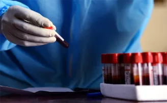 ‘ରାଉରକେଲା ଆଇଜିଏଚ୍‌ରେ ହେବ ପ୍ଲାଜମା ଥେରାପି’