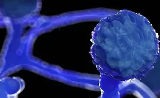 ବ୍ଲାକ ଫଙ୍ଗସକୁ ମହାମାରୀ ଘୋଷଣା କଲା ଏହି ରାଜ୍ୟ