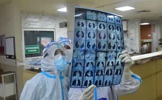 ଡେଲଟା ପ୍ଲସ ଭାରିଆଣ୍ଟ ଫୁସଫୁସକୁ ଅଧିକ ସଂକ୍ରମଣ କରୁଛି: ଏନଟିଏଜିଆଇ ମୁଖ୍ୟ