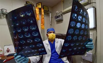 ଟିକା ନେଇଥିବା ଡାକ୍ତର କୋଭିଡର ଦୁଇଟି ଭାରିଆଣ୍ଟରେ ସଂକ୍ରମିତ