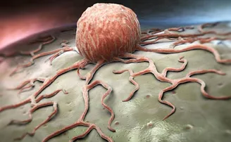 ଇତିହାସରେ ପ୍ରଥମ: ଔଷଧରେ ଉଭେଇ ଗଲା କ୍ୟାନସର!