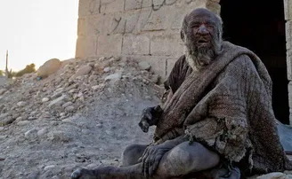 ଆରପାରିରେ ବିଶ୍ୱର ସବୁଠାରୁ ମ୍ଳେଛ ମଣିଷ, ୯୪ ବର୍ଷରେ ଗାଧୋଇବା ପରେ ଚାଲିଗଲେ