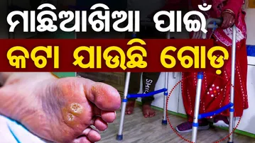 ମାଛିଆଖିଆ ପାଇଁ କଟା ଯାଉଛି ଗୋଡ଼|| Health issues ||  Foot Infection Alert || Odisha Reporter