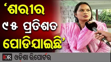 ‘ଶରୀର ୯୫ ପ୍ରତିଶତ ପୋଡିଯାଇଛି’ | Odisha Reporter