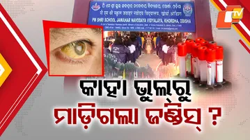 Jaundice outbreak at a Navodaya school.