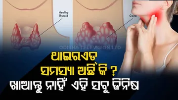 Thyroid and diet factsheet