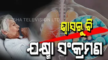 TB is caused by the breath of infected person