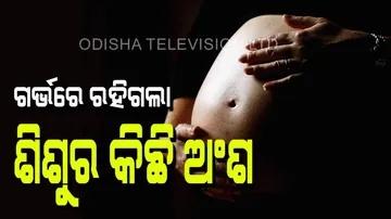 Baby remains left inside woman womb