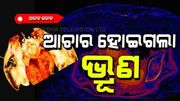 Foetus preserved in mummy womb turned into pickle