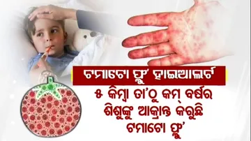 Karnataka Sounds High Alert Over Tomato Flu