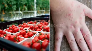 What is tomato flu? Who does it affect?