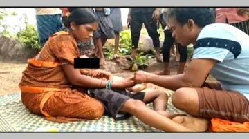 Snake Bite Treatment