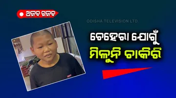 27  year old man looks like 12 can not get a job