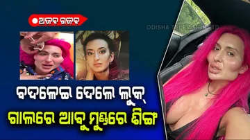 Worlds biggest cheeks woman now grows horns