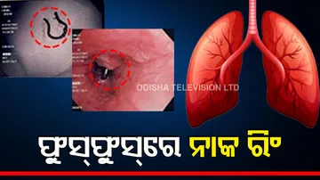 nose ring found in lungs