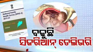 c-section deliveries