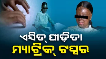 Acid attack survivor 