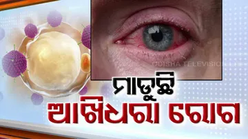 Conjunctivitis spreads in Odisha