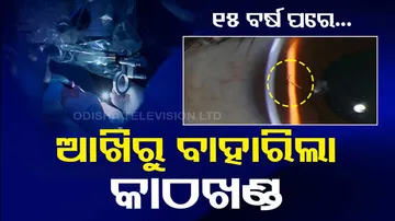 Doctors discover us man boston living with a wooden splinter in his eye for over 15 years