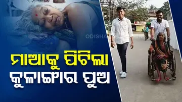 Son Bitten His Mother