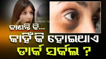 Dark Circles Home Remedies