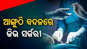 surgery on child's tongue