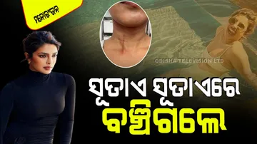 Priyanka chopra gets huge cut during shooting for stunt scenes