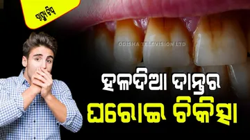 How To Whiten Yellow Teeth