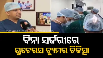 Uterus Tumor Treatment