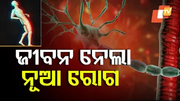 GBS cases surge in Pune Maharashtra  