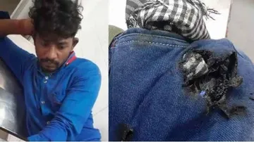 ମୋବାଇଲ ଫାଟି ଯୁବକ ଆହତ