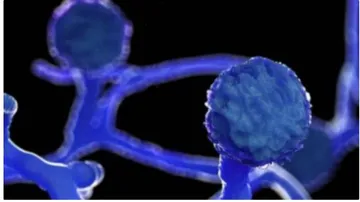 ଭୀମସାରରେ ସନ୍ଦିଗ୍ଧ ବ୍ଲାକ୍ ଫଙ୍ଗସ୍ ରୋଗୀଙ୍କ ମୃତ୍ୟୁ