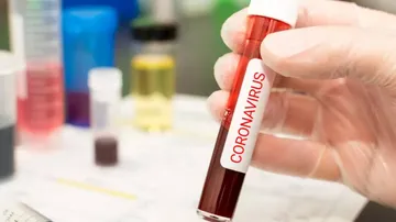 ଆଜି ରାଜ୍ୟରେ ସୁସ୍ଥ ହେଲେ ଆଉ ୩୧୧୦ କରୋନା ଆକ୍ରାନ୍ତ