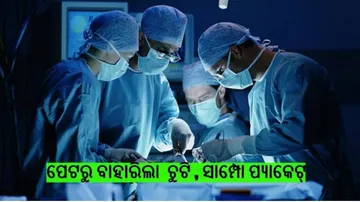 ନାବାଳିକାଙ୍କ ପେଟରୁ ବାହାରିଲା ଅଧ କେଜିର ମଣିଷ ଚୁଟି ଓ ସାମ୍ପୋ ପ୍ୟାକେଟ୍‌